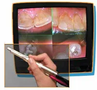 Intraoral Camera