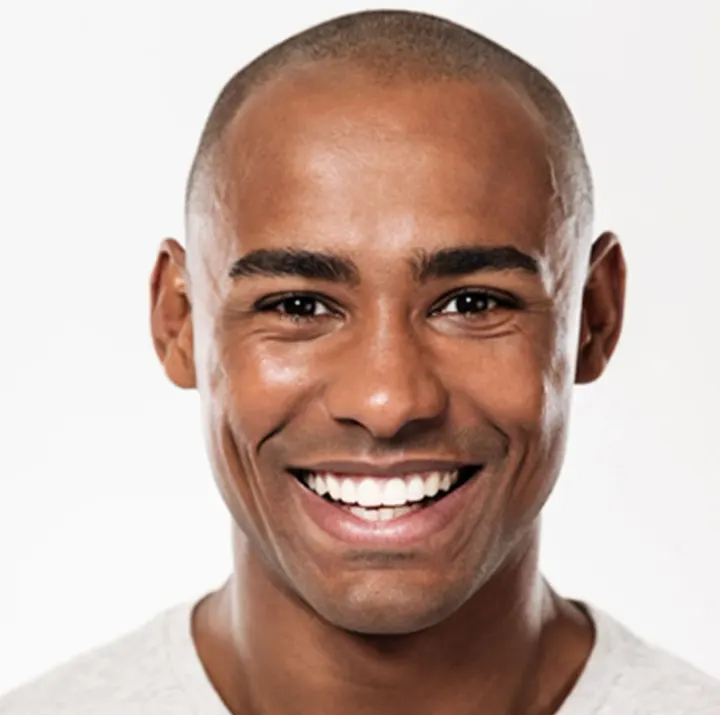 Ceramic veneers and crowns